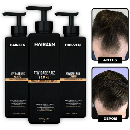 Hairzen Hair Root Shampoo