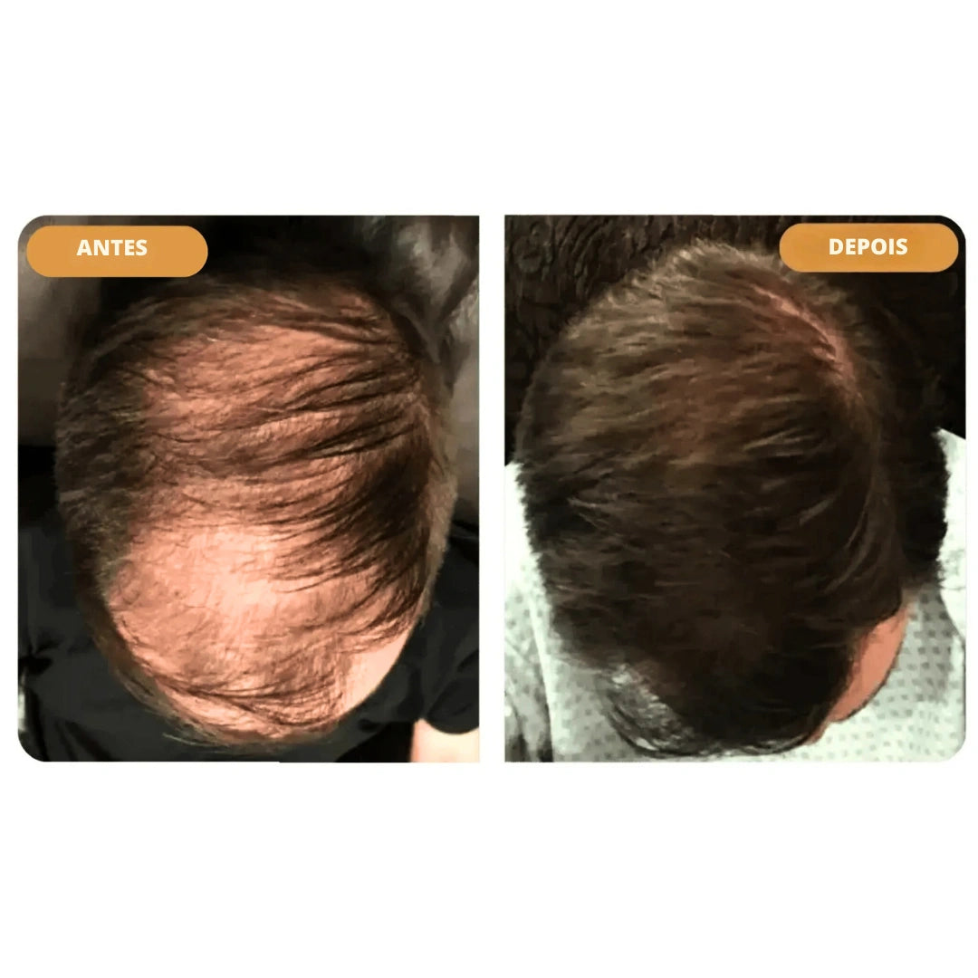 Hairzen Hair Root Shampoo