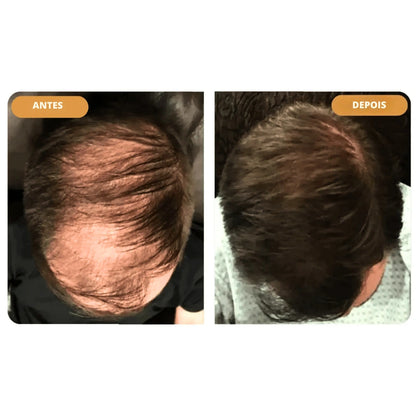 Hairzen Hair Root Shampoo