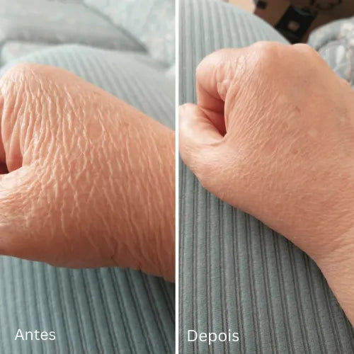 Mokio – Novaderm Creme Reparador Corporal