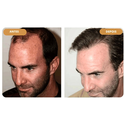 Hairzen Hair Root Shampoo